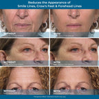 Rapid Reduction Serum – 1-Month Supply